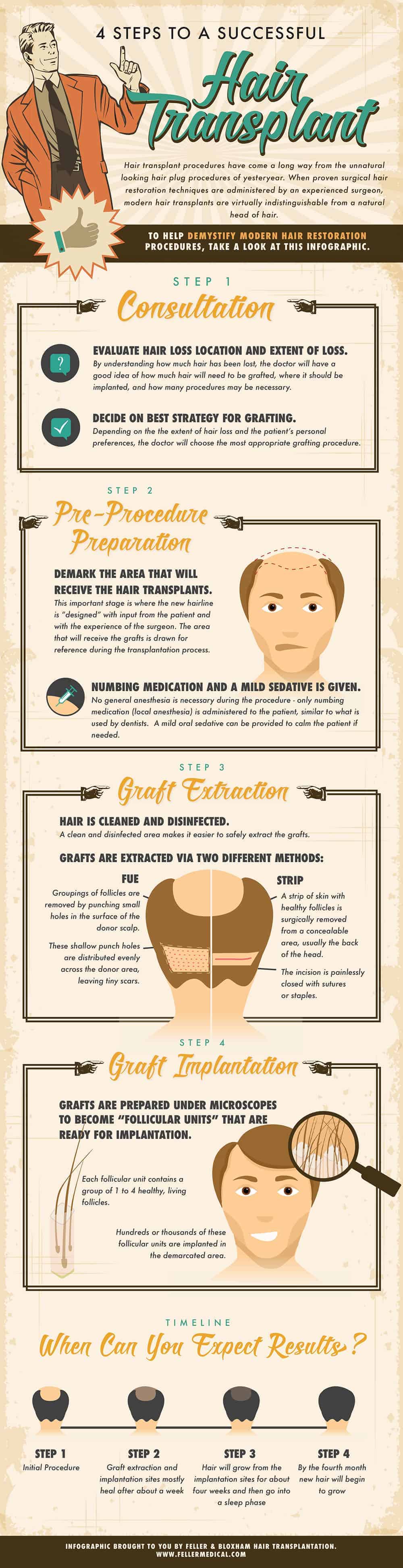 does hair transplant work