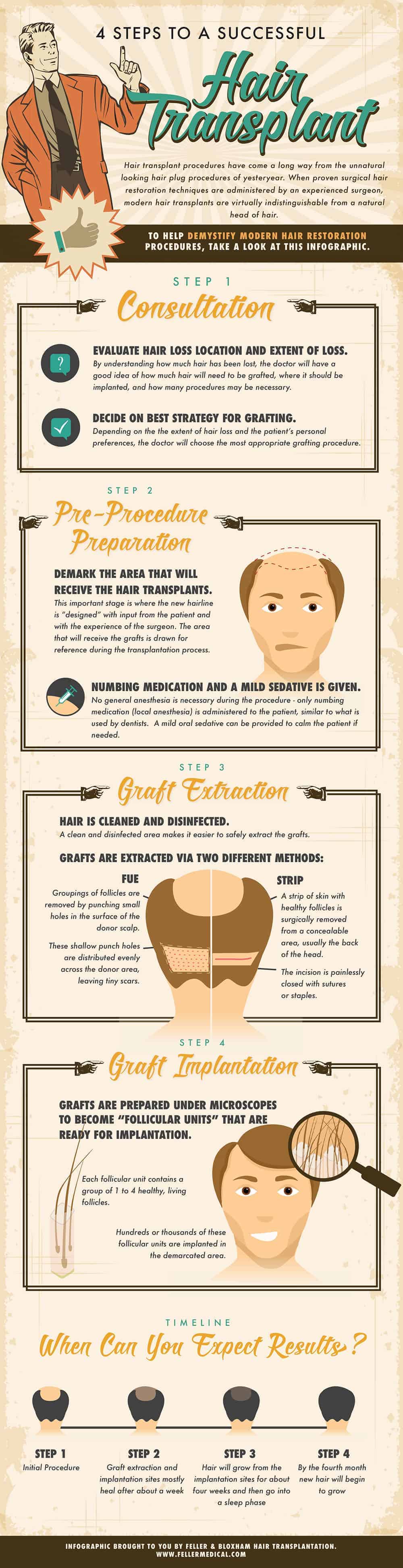 4 Steps to a Successful Hair Transplant